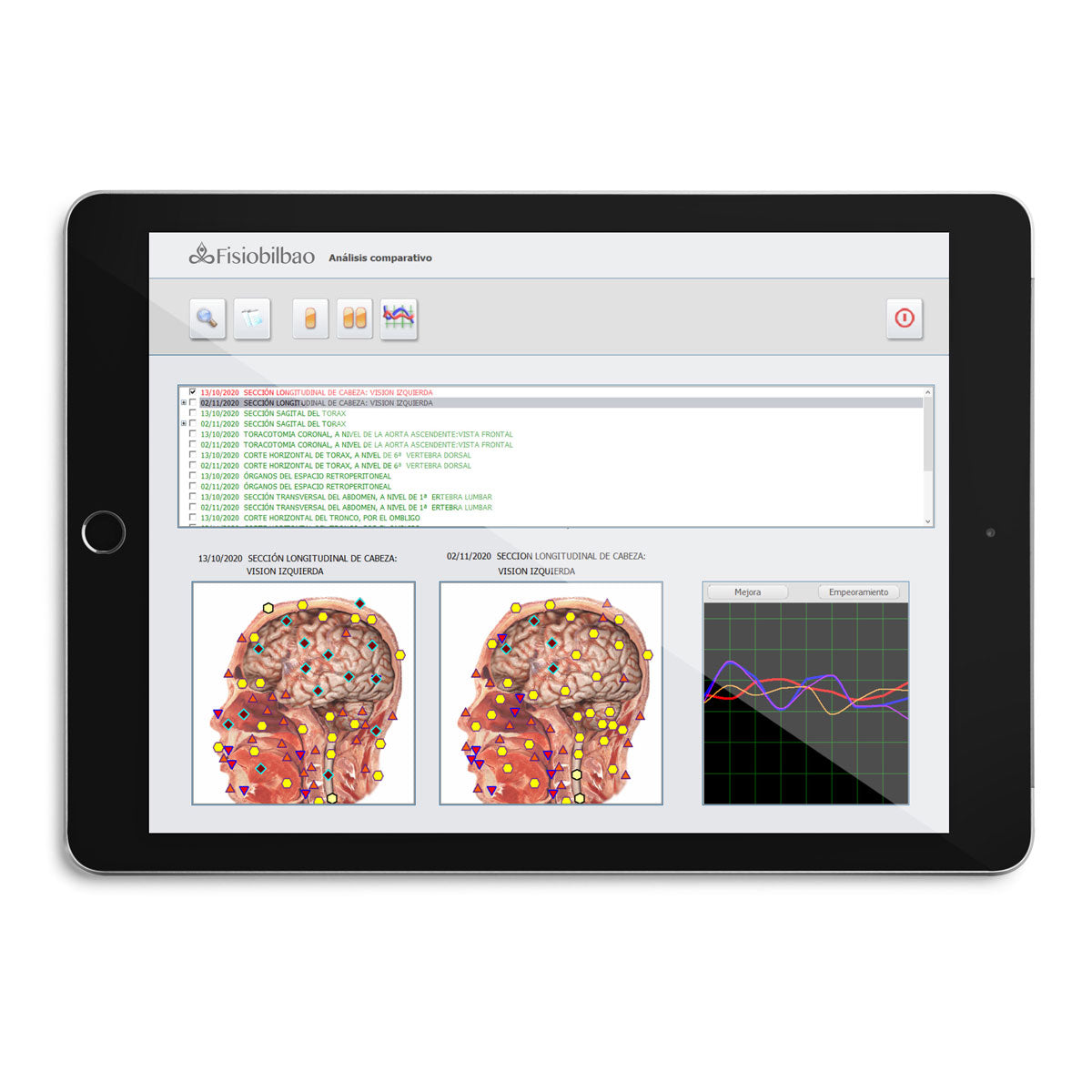 ESBIA (Advanced Biointegral Scanner).