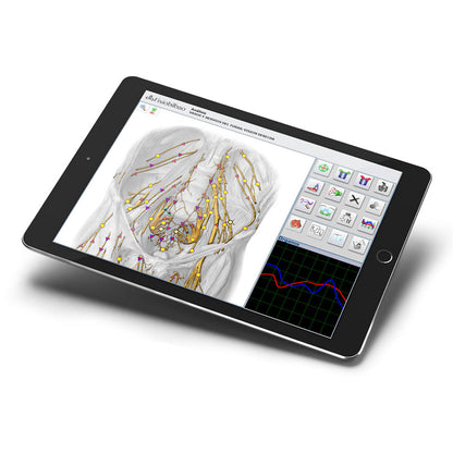 ESBIA (Advanced Biointegral Scanner).
